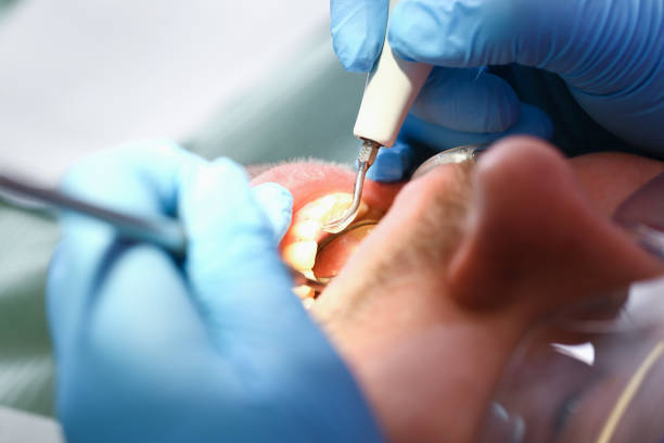 Best Knocked-Out Tooth Emergency  in Camden, AL