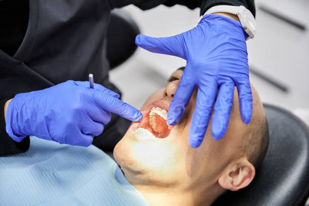 Best Root Canal Emergency Dentist  in Camden, AL
